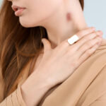 COMO TIRAR A MARCA DE UM CHUPÃO NO PESCOÇO / Acidez Mental