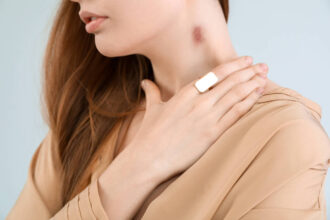 COMO TIRAR A MARCA DE UM CHUPÃO NO PESCOÇO / Acidez Mental